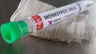 Pakistan’da birinci maymun çiçeği virüsü hadisesi görüldü